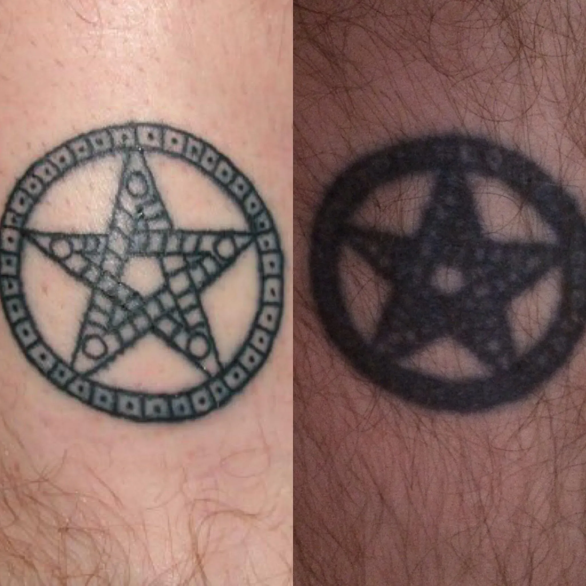 LongTerm Care for Your Tattoo Designs That Age Well